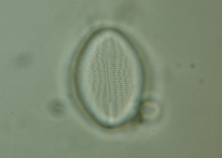 Cocconeis pediculus?